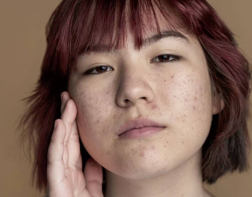 Close Up Skin Pores During Face Care Routine 960x750 1